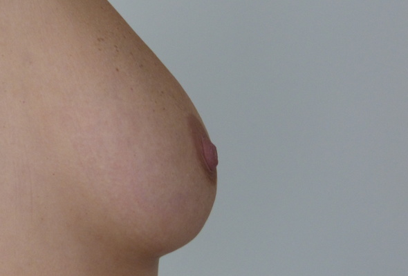 tit, nipple, closeup, breast, peitos