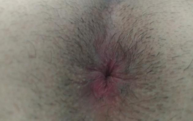 ass, butthole, nude, closeup, butt, asshole, hi-q, hairy, anus